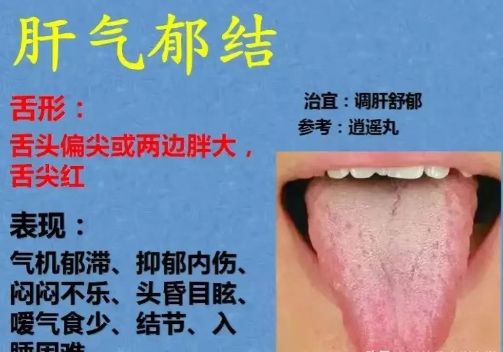 舌诊