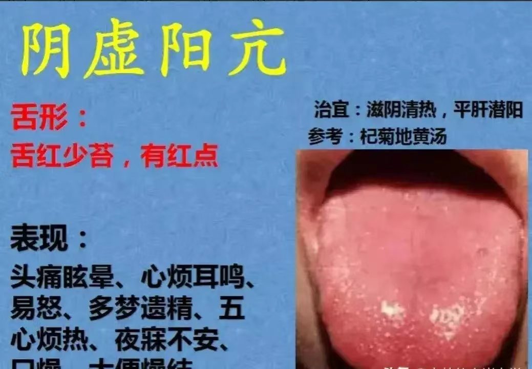 舌诊