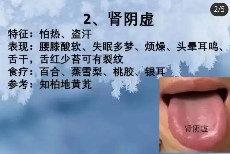 舌诊