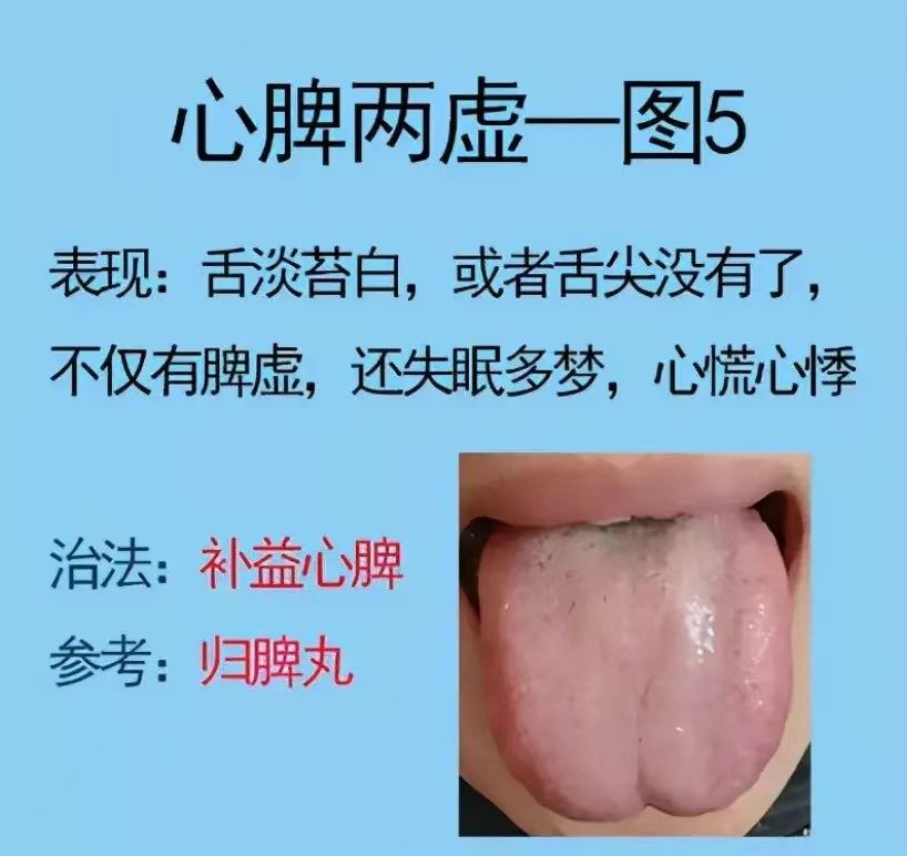 舌诊