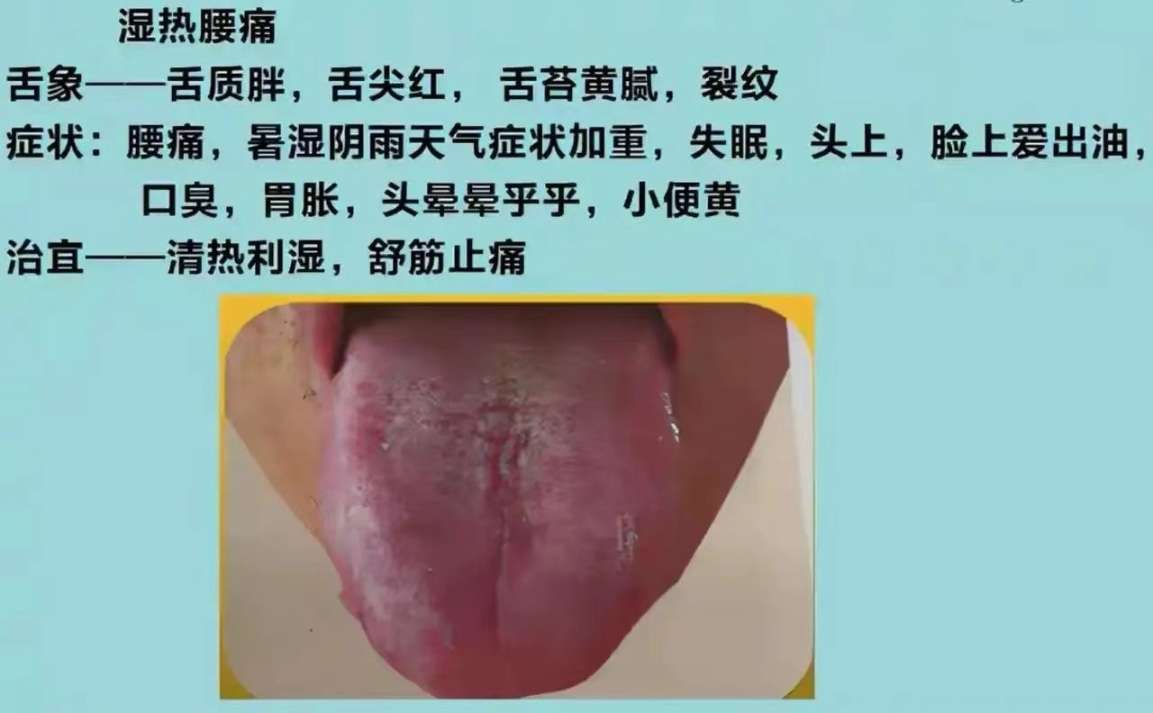 舌诊