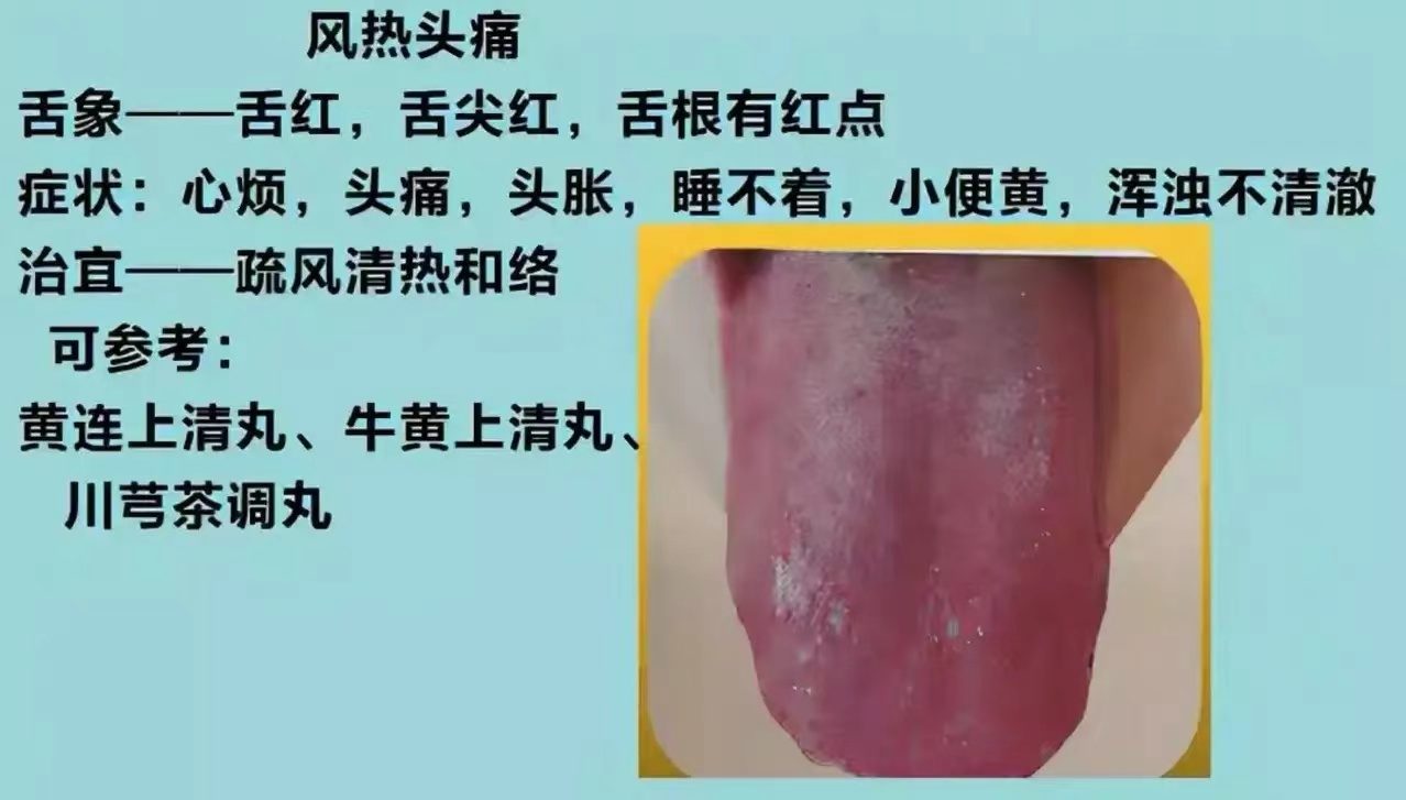 舌诊