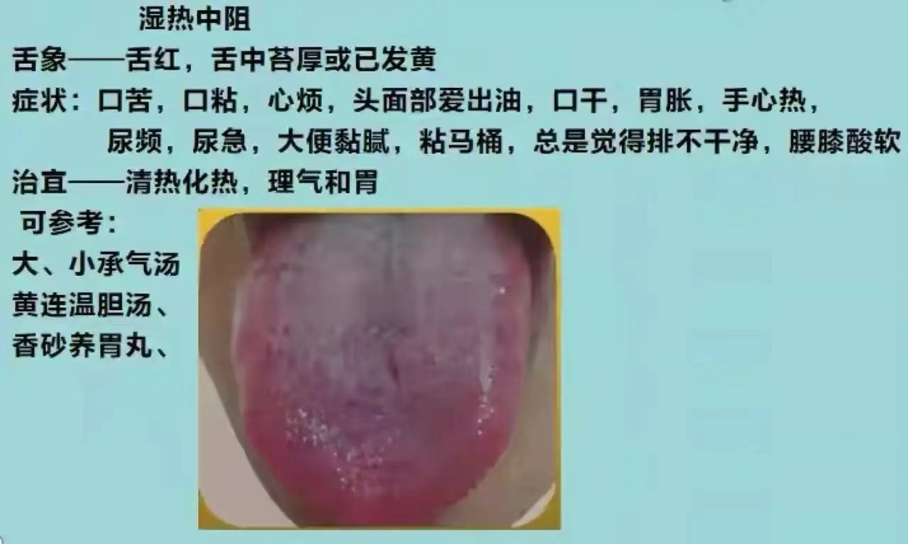 舌诊