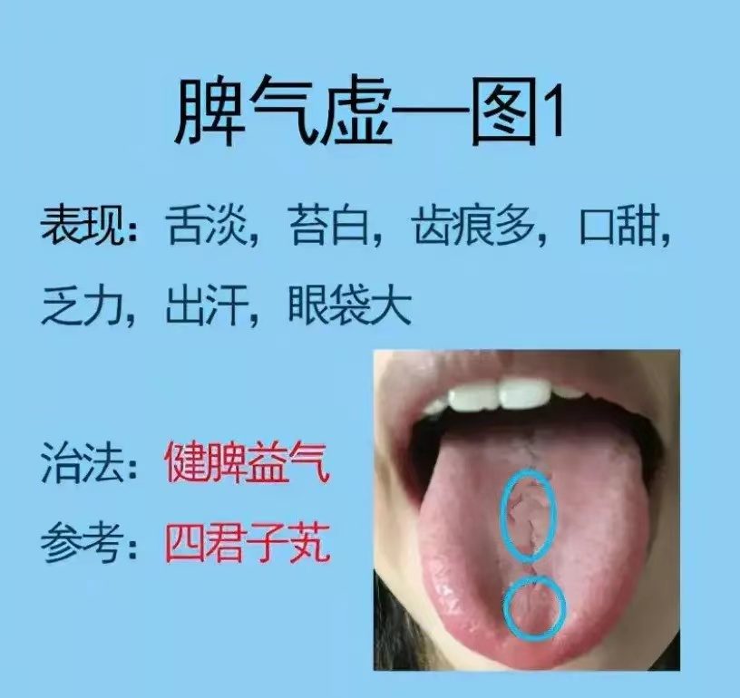 舌诊