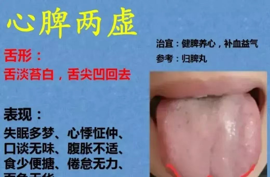 舌诊