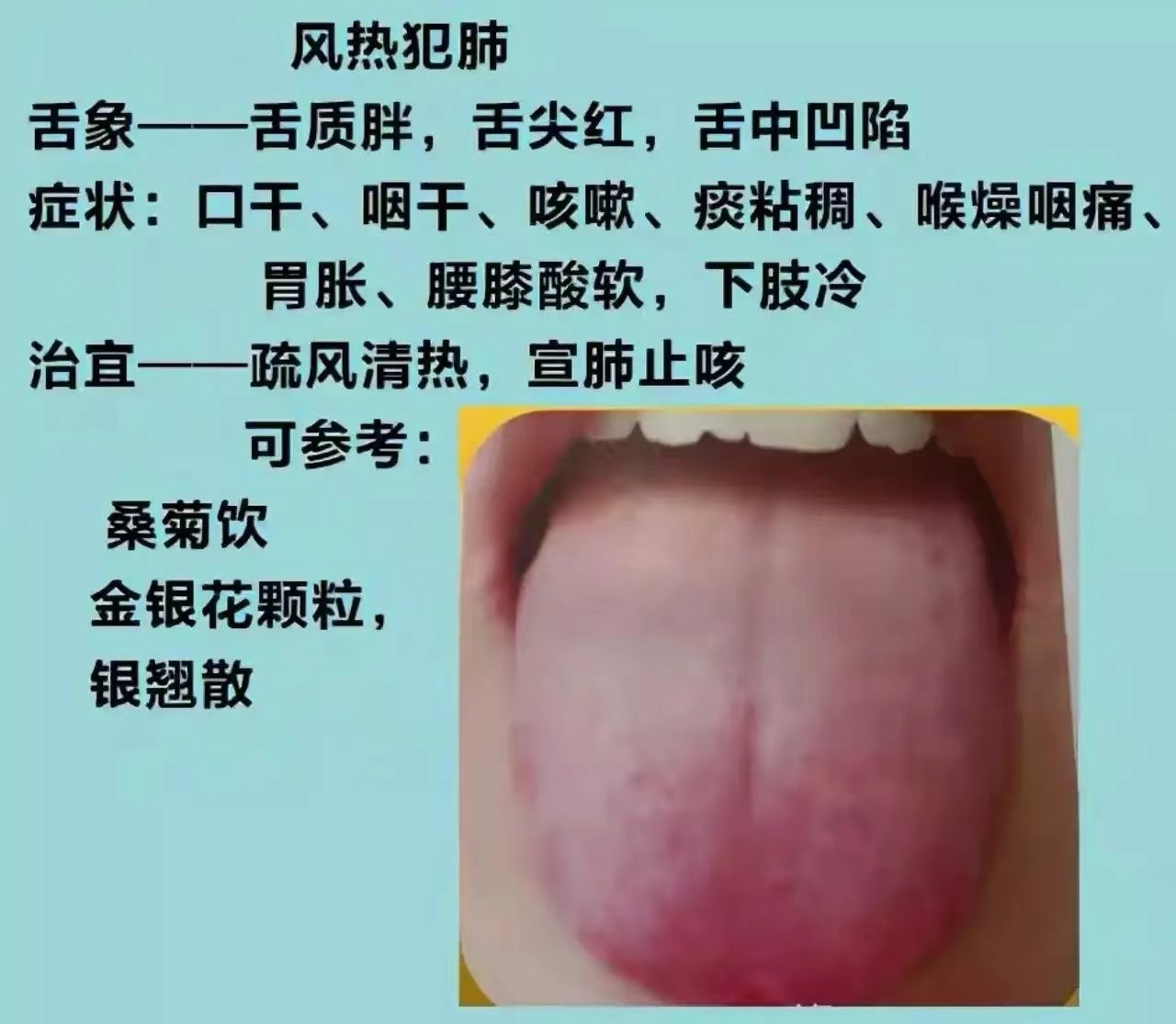 舌诊