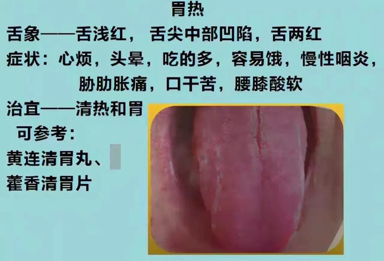 舌诊