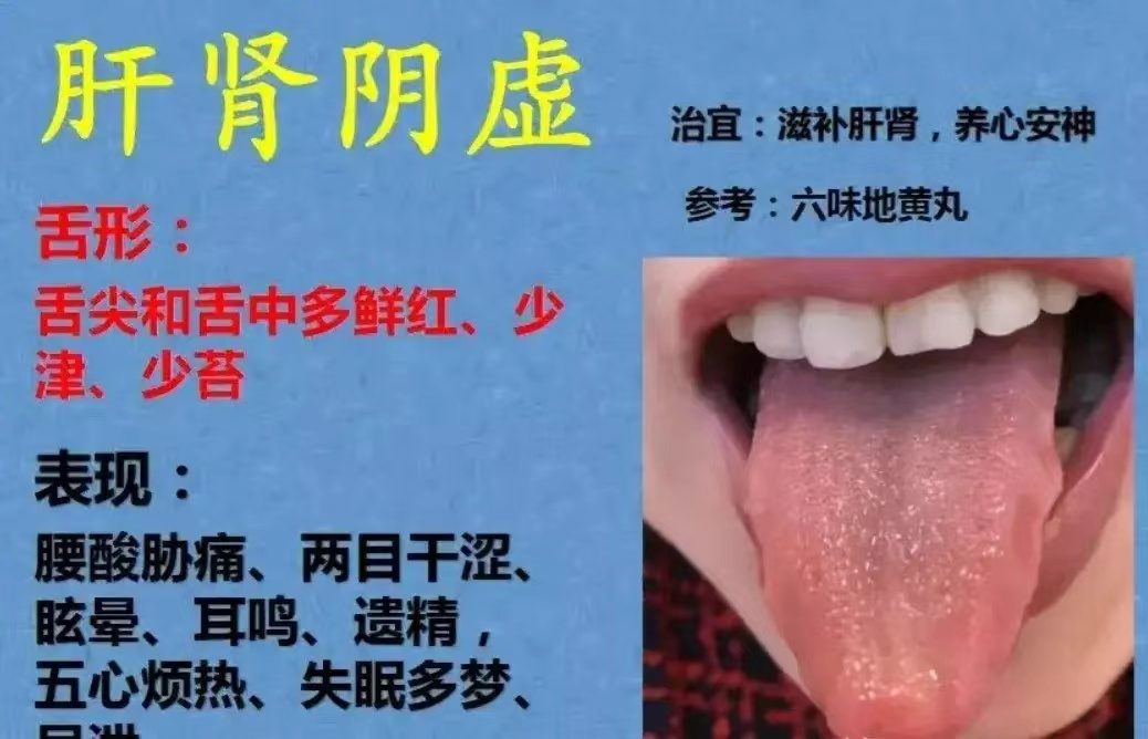 舌诊